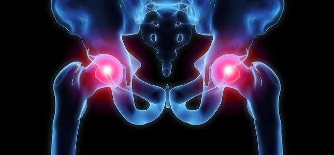 12 metod přírodní léčby a snižování bolestí při revmatismu a artritidě - byroncaspergolf.com